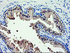 Anti-ACSS2 Mouse Monoclonal Antibody [clone: OTI2C6]