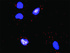 Anti-OSM + COL4A6 Antibody Pair