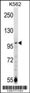 Anti-NAA15 Rabbit Polyclonal Antibody (HRP (Horseradish Peroxidase))
