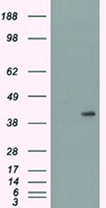 Anti-KRT19 Mouse Monoclonal Antibody [clone: OTI3F8]