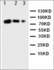 Western blot analysis of Lane 1: Recombinant Human CD80 Protein 10ng, Lane 2: Recombinant Human CD80 Protein 5ng, Lane 3: Recombinant Human CD80 Protein 2.5ng using CD80 antibody.