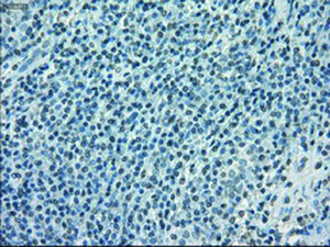 Anti-POR Mouse Monoclonal Antibody [clone: OTI5H5]