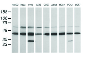 Anti-MAP2K1 Mouse Monoclonal Antibody [clone: OTI7F3]