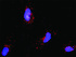 Anti-PDGFRB + PTEN Antibody Pair