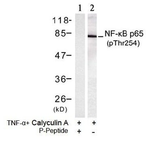 Western blot analysis of extracts from HT-29 cells using NF-ÎºB p65 (phospho-Thr254) antibody