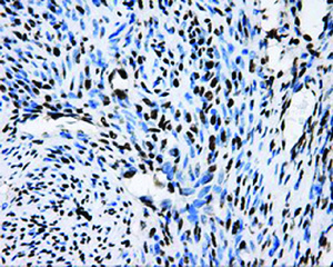 Anti-RPA2 Mouse Monoclonal Antibody [clone: OTI9A1]