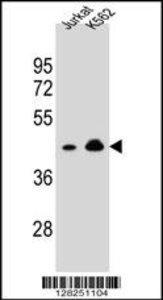 Anti-OR10A4 Rabbit Polyclonal Antibody