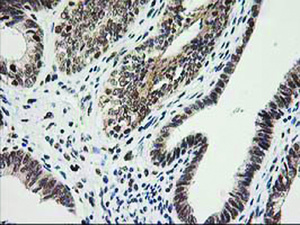 Anti-ERCC4 Mouse Monoclonal Antibody [clone: OTI4E11]