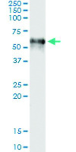 Anti-F9 Antibody Pair