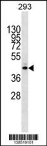 Anti-METTL2B Rabbit Polyclonal Antibody (HRP (Horseradish Peroxidase))