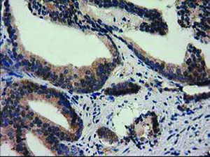 Anti-SQSTM1 Mouse Monoclonal Antibody [clone: OTI4G9]