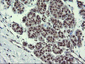 Anti-NUMB Mouse Monoclonal Antibody [clone: OTI4F3]