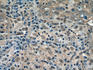 Anti-GPATCH2 Rabbit Polyclonal Antibody