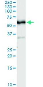 Anti-CDC25C Antibody Pair