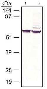Anti-ATP7B Rabbit Polyclonal Antibody (DyLight® 550)