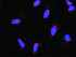 Anti-PDGFA + PLCG1 Antibody Pair