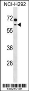 Anti-MCCC2 Rabbit Polyclonal Antibody (Biotin)