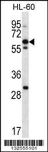 Anti-NPTXR Rabbit Polyclonal Antibody (FITC (Fluorescein Isothiocyanate))