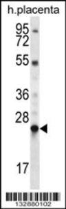 Anti-LHFPL1 Rabbit Polyclonal Antibody (APC (Allophycocyanin))