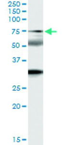 Anti-ZNF18 Polyclonal Antibody Pair