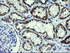 Anti-GLB1 Mouse Monoclonal Antibody [clone: OTI2F6]