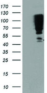 Anti-SERPINB13 Mouse Monoclonal Antibody [clone: OTI1B12]
