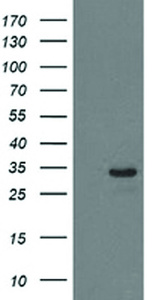 Anti-HDHD2 Mouse Monoclonal Antibody [clone: OTI4G3]