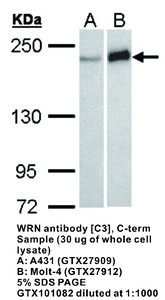 Anti-WRN Rabbit Polyclonal Antibody