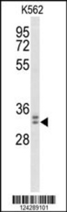 Anti-WDR83 Rabbit Polyclonal Antibody (AP (Alkaline Phosphatase))