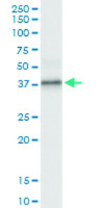 Anti-PPP1R3C Polyclonal Antibody Pair