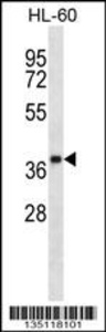 Anti-OR5F1 Rabbit Polyclonal Antibody (AP (Alkaline Phosphatase))
