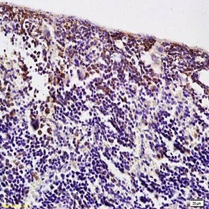 Immunohistochemical analysis of formalin-fixed and paraffin embedded mouse spleen tissue (dilution at:1:200) using ACBD6 antibody