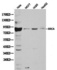 Western blot analysis of extracts of various cell line lysates using BRCA1 antibody