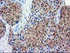 Anti-DSTN Mouse Monoclonal Antibody [clone: OTI1C5]