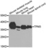 Western blot analysis of extracts of various tissues using TPM3 antibody