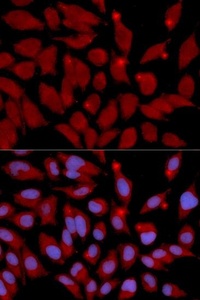 Immunofluorescense analysis of U2OS cell using DNMT3A antibody