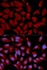 Immunofluorescense analysis of U2OS cell using DNMT3A antibody