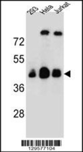 Anti-OR4C13 Rabbit Polyclonal Antibody (Biotin)