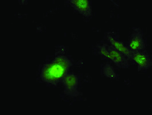 Anti-SDS Mouse Monoclonal Antibody [clone: OTI1C8]