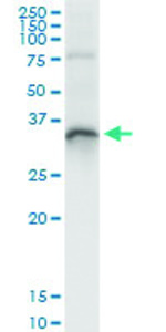 Anti-DHRS9 Polyclonal Antibody Pair