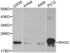 Western blot analysis of extracts of various cell lines using RHOC antibody