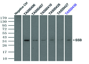 Anti-SSB Mouse Monoclonal Antibody [clone: OTI3F11]
