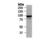 Western blot analysis of Catenin beta (BSENS-1234-100) in extracts from HT29 cells.