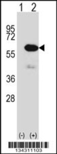 Anti-METAP2 Rabbit Polyclonal Antibody (Biotin)