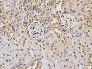 IHC-P staining of rat brain tissue using CDC25C antibody (primary antibody dilution at 1:100)