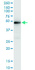 Anti-XRCC4 Polyclonal Antibody Pair