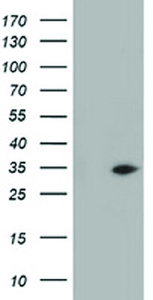 Anti-GGPS1 Mouse Monoclonal Antibody [clone: OTI2E7]