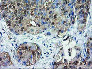 Anti-DSTN Mouse Monoclonal Antibody [clone: OTI1C5]