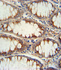 Anti-NEUROG3 Rabbit Polyclonal Antibody (FITC (Fluorescein Isothiocyanate))