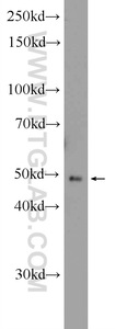 Anti-ZNF645 Rabbit Polyclonal Antibody